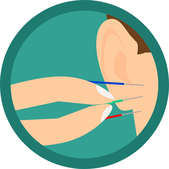 Få hjælp til at lindre smerter med øreakupunktur